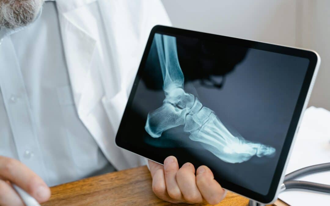 Diplôme espagnol de manipulateur radio : peut-on exercer en France après une formation en imagerie médicale ?